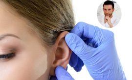 Chirurgia estetica orecchie Giacomo Urtis